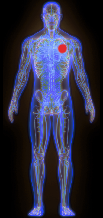 Human body icon outlining an example of the effects of tumor-selective immunotherapies for a person with lung cancer